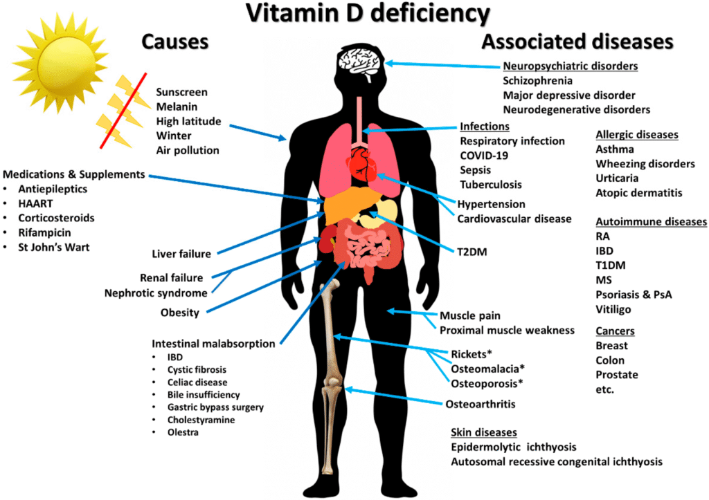 Signs of Vitamin D Deficiency, vitamin d supplement, 14 signs of vitamin d deficiency, vitamin d deficiency symptoms, vitamin d foods, weird symptoms of vitamin d deficiency, low vitamin d symptoms female, vitamin d deficiency treatment, vitamin d deficiency causes which disease, How do you feel when your vitamin D is extremely low, How to increase vitamin D in the body, What is the best way to absorb vitamin D, How long does it take to restore vitamin D levels, What food is highest in vitamin D, What happens when your D is low, Which fruit is best for vitamin D, How can I raise my vitamin D level fast, How can I increase my D naturally, When to take vitamin D, morning or night, What is a normal vitamin D level, How to test for vitamin deficiency, What are the symptoms of lack of vitamin D, Do vitamin D tablets work, How can I recover from vitamin D deficiency fast, What drink is high in vitamin D, Which dry fruits are rich in vitamin D, How do you get 100% vitamin D, How do you treat severely low vitamin D, Why do I feel so ill with low vitamin D, What are the neurological symptoms of vitamin D deficiency, How to check vitamin D levels at home, How can I get vitamin D in my system fast, Does vitamin D affect MS, What drink is high in vitamin D, What causes poor vitamin D, How to increase vitamin D quickly, What happens when vitamin D is low,